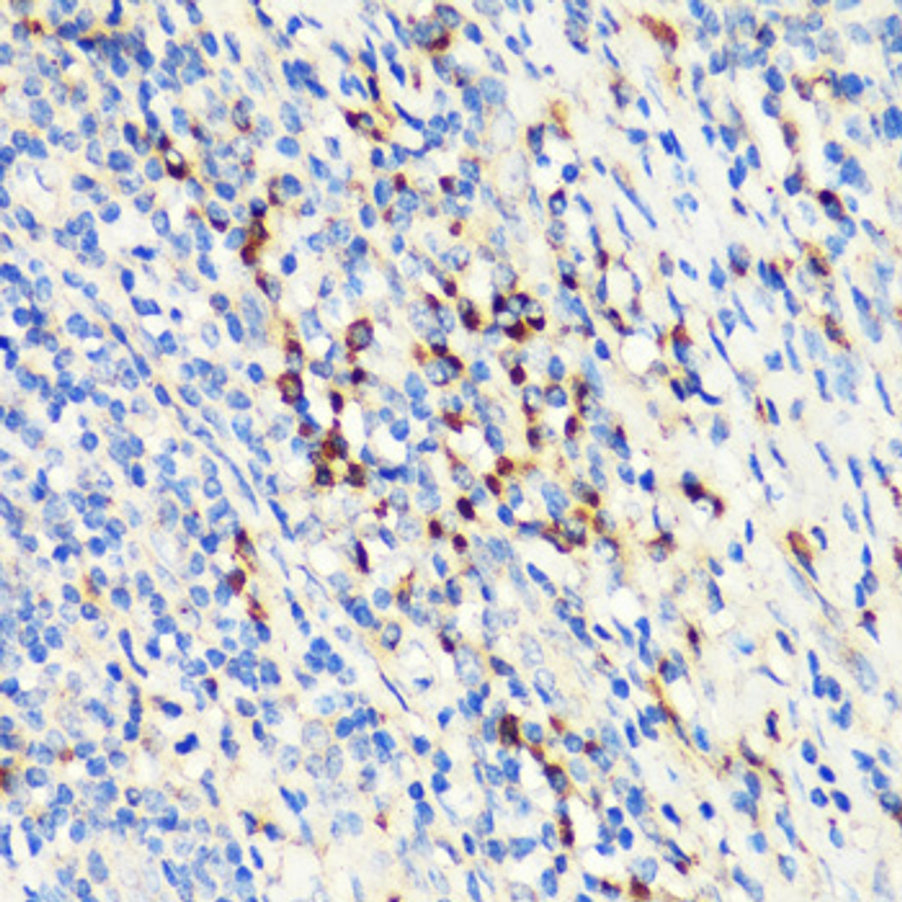 Immunohistochemistry of paraffin-embedded Human tonsil using TNFSF11 Polyclonal Antibody at dilution of  1:200 (40x lens).