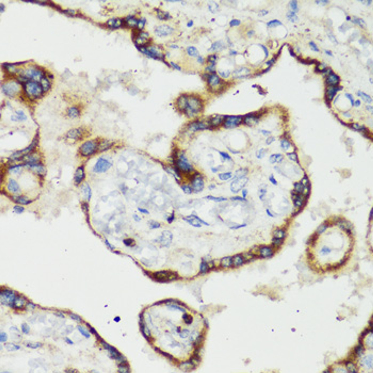 Immunohistochemistry of paraffin-embedded Human placenta using TNFSF11 Polyclonal Antibody at dilution of  1:200 (40x lens).