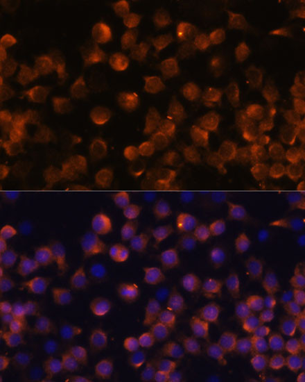 Immunofluorescence analysis of Raw264.7 cells using Complement Factor B Polyclonal Antibody at dilution of  1:100 (40x lens). Blue: DAPI for nuclear staining.