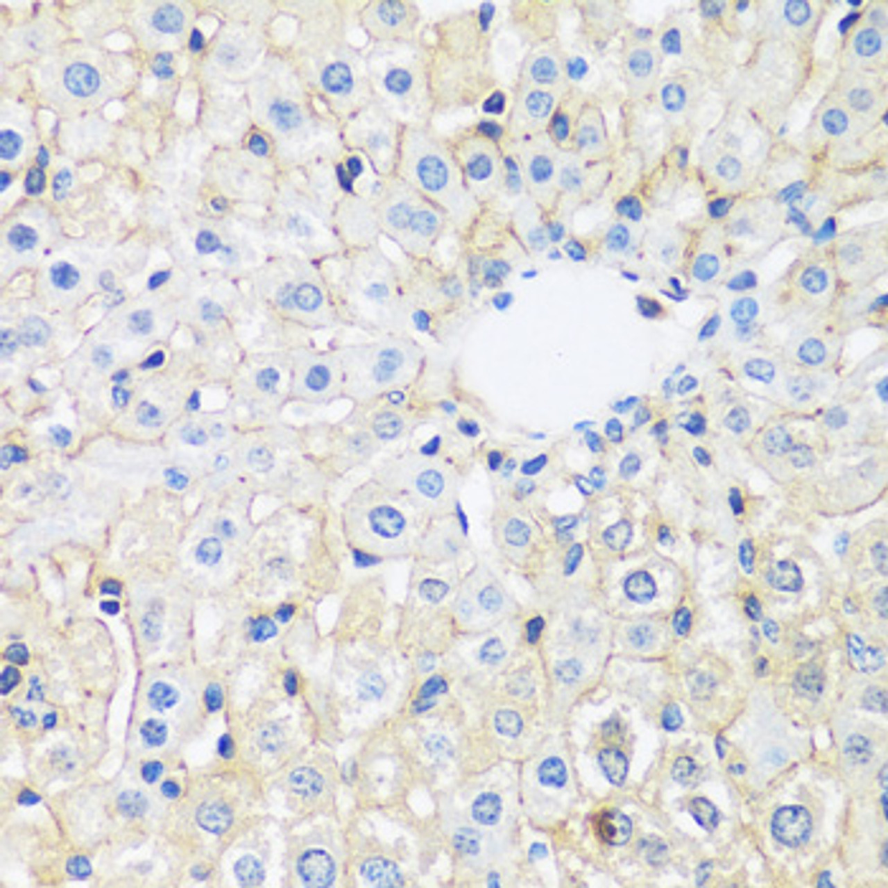 Immunohistochemistry of paraffin-embedded Rat liver using ARL4A Polyclonal Antibody at dilution of  1:100 (40x lens).