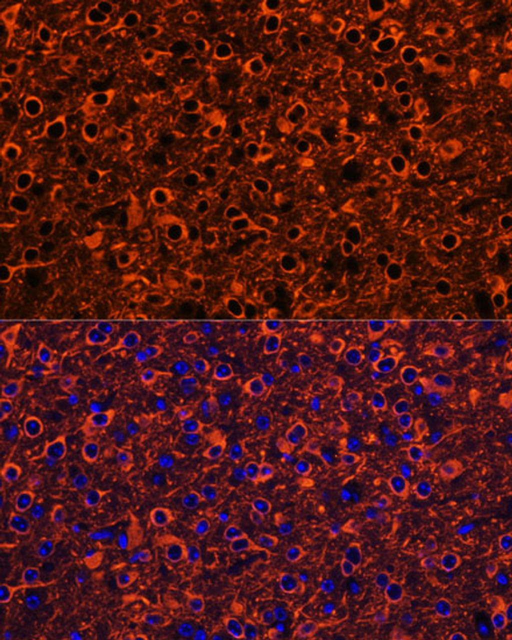 Immunofluorescence analysis of Mouse brain using TUBB3 Polyclonal Antibody at dilution of  1:100. Blue: DAPI for nuclear staining.