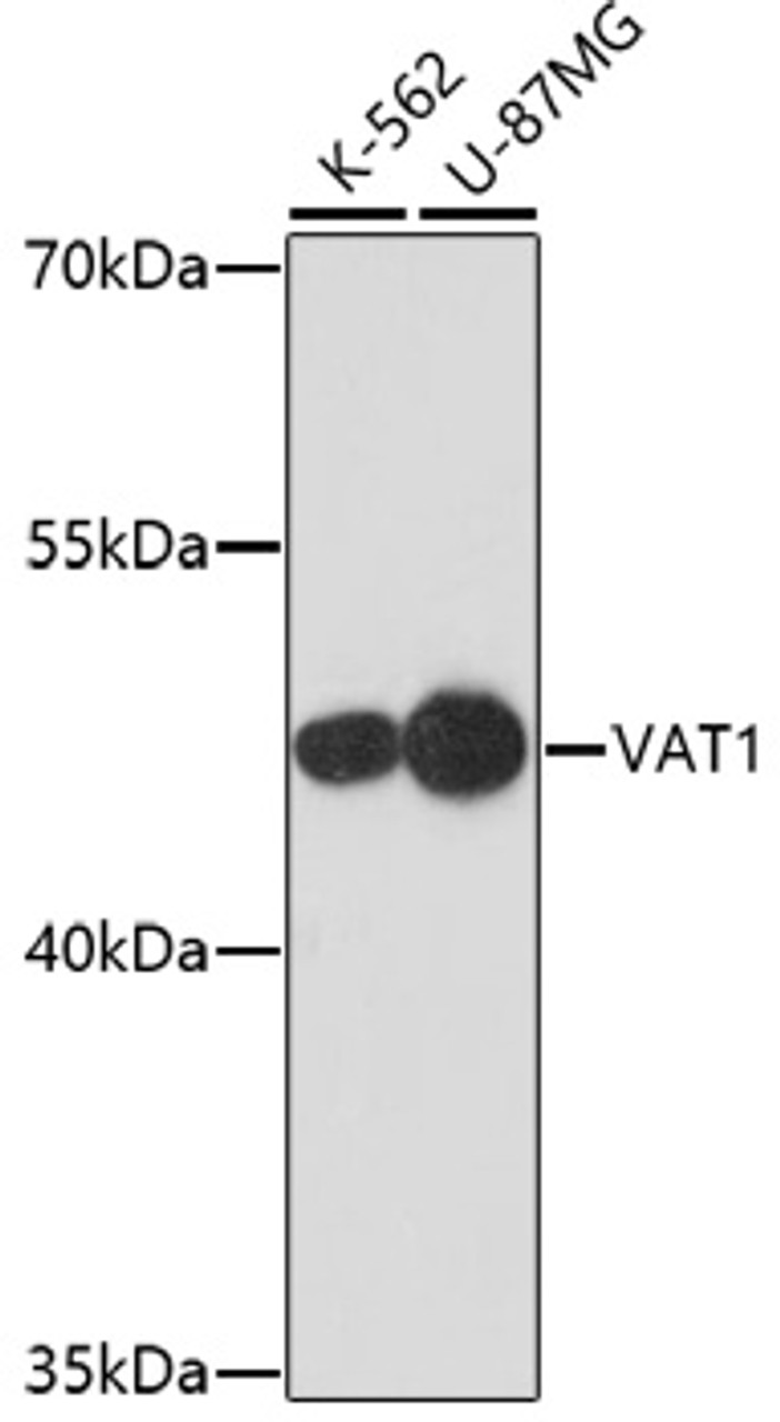 Western blot analysis of extracts of various cell lines using VAT1 Polyclonal Antibody at dilution of 1:1000.