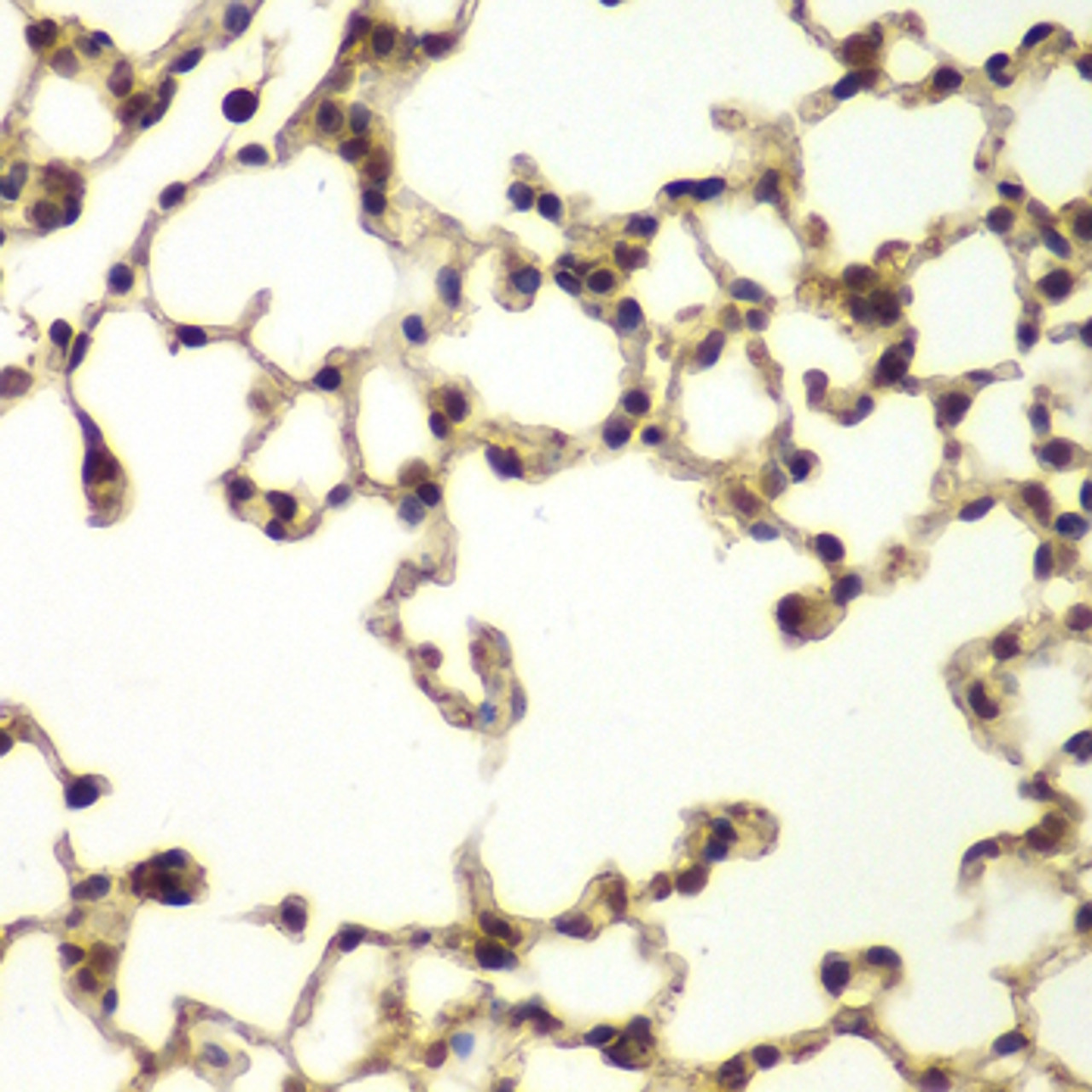 Immunohistochemistry of paraffin-embedded Mouse lung using ERCC3 Polyclonal Antibody at dilution of  1:200 (40x lens).
