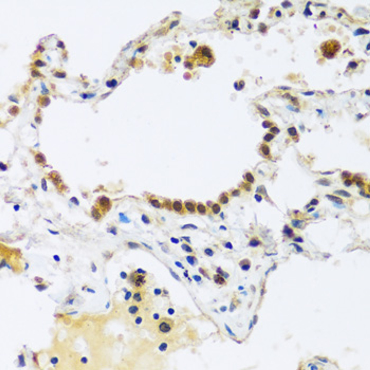 Immunohistochemistry of paraffin-embedded Human lung using ARL6IP4 Polyclonal Antibody at dilution of  1:100 (40x lens).