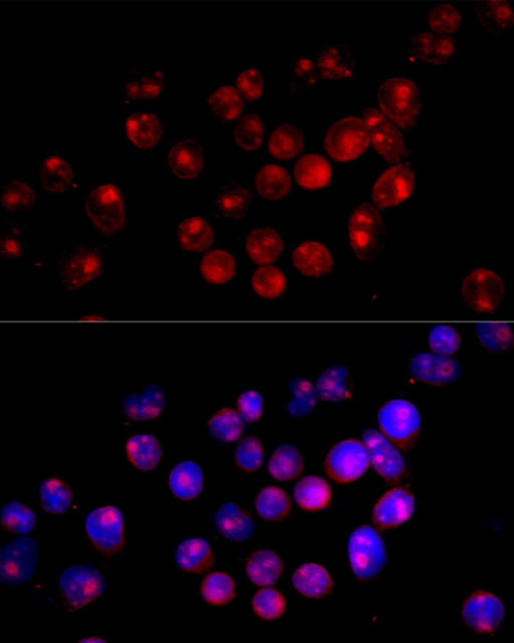 Immunofluorescence analysis of HeLa cells using CYP27B1 Polyclonal Antibody at dilution of  1:100 (40x lens). Blue: DAPI for nuclear staining.