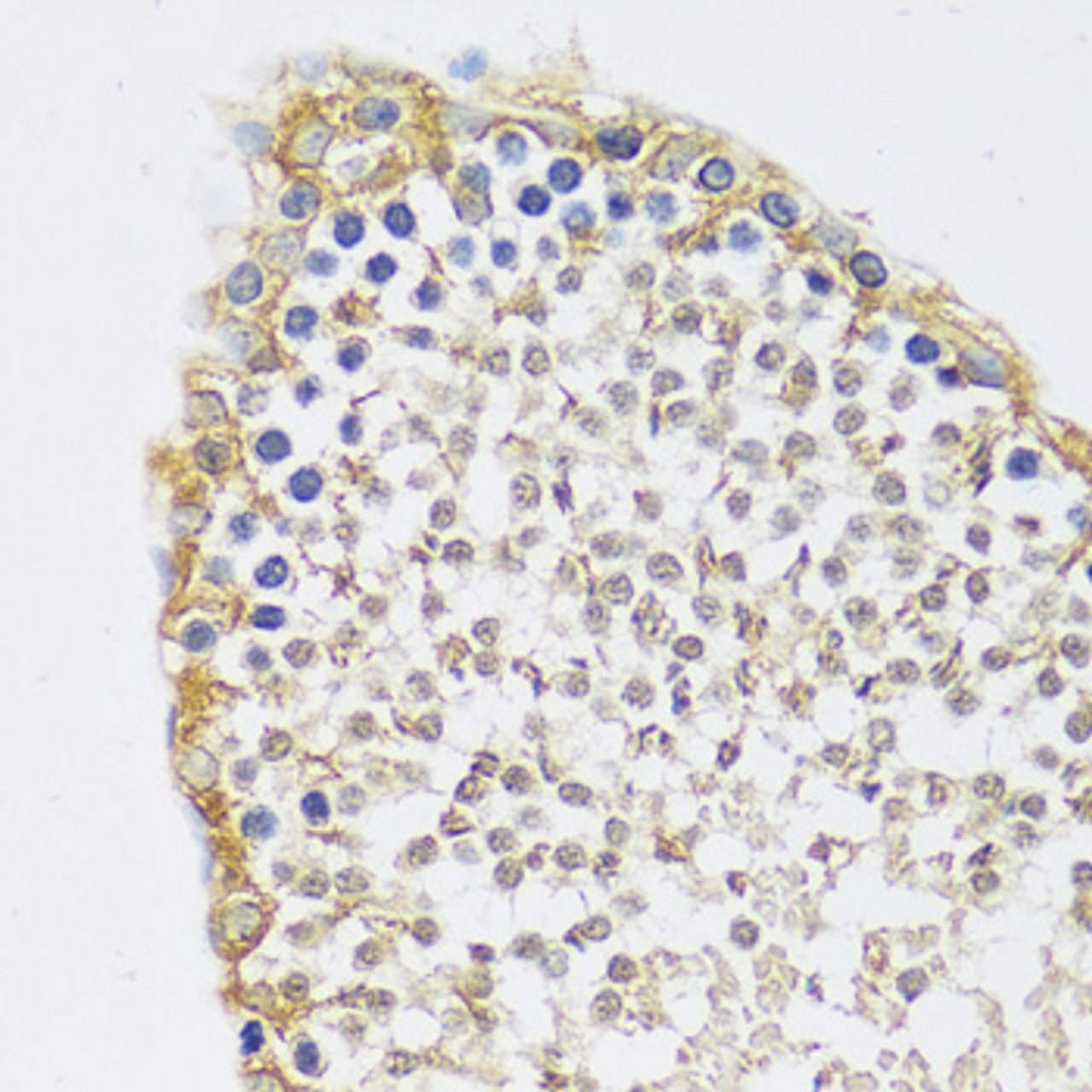 Immunohistochemistry of paraffin-embedded Rat testis using C12orf10 Polyclonal Antibody at dilution of  1:100 (40x lens).