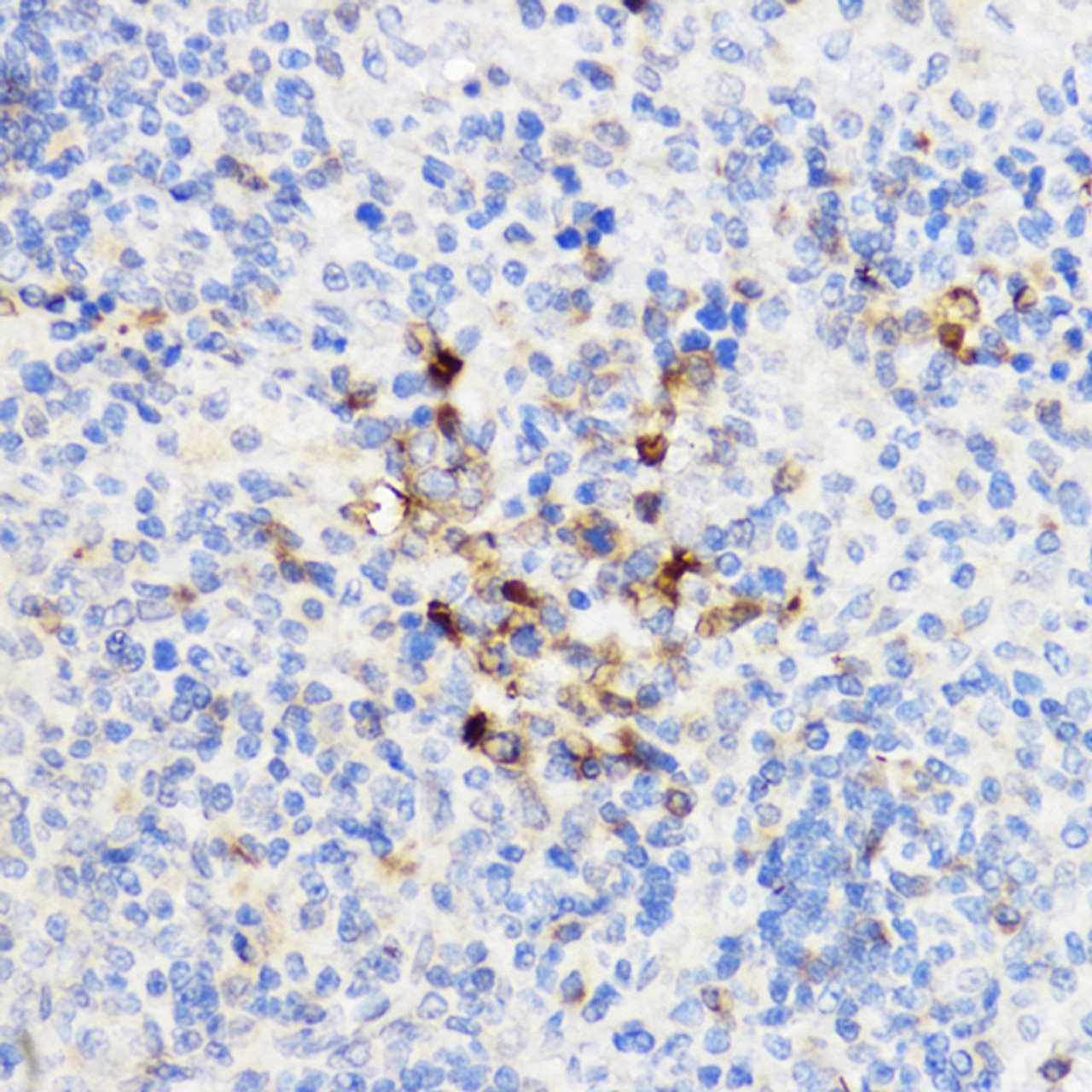 Immunohistochemistry of paraffin-embedded Rat spleen using YKL-40 / CHI3L1 Polyclonal Antibody at dilution of  1:100 (40x lens).