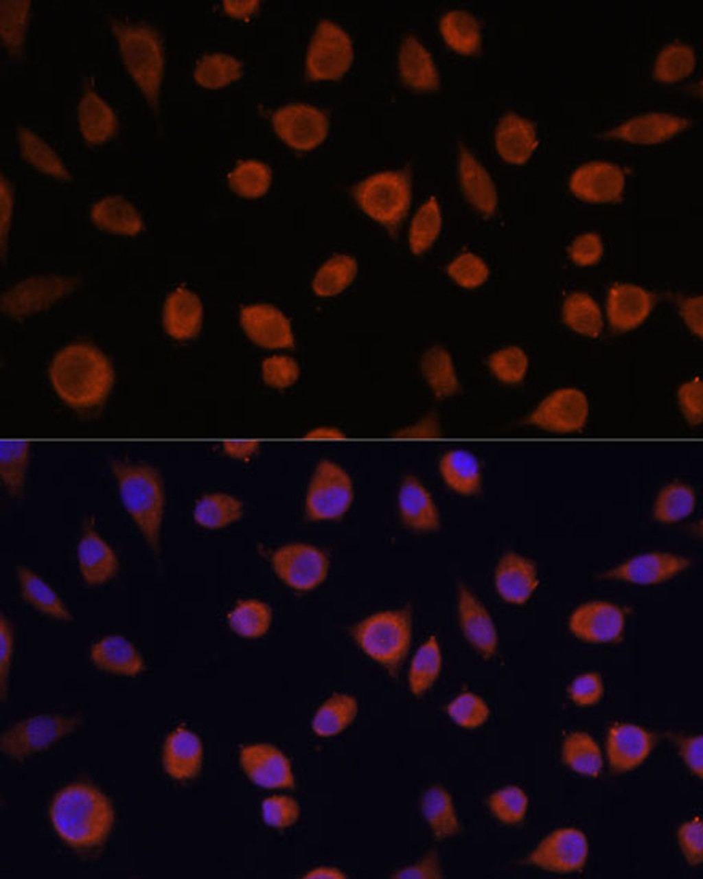 Immunofluorescence analysis of L929 cells using ZCCHC3 Polyclonal Antibody at dilution of  1:100. Blue: DAPI for nuclear staining.