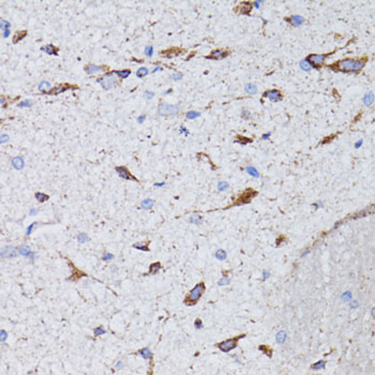 Immunohistochemistry of paraffin-embedded Rat brain using AVP Polyclonal Antibody at dilution of  1:100 (40x lens).
