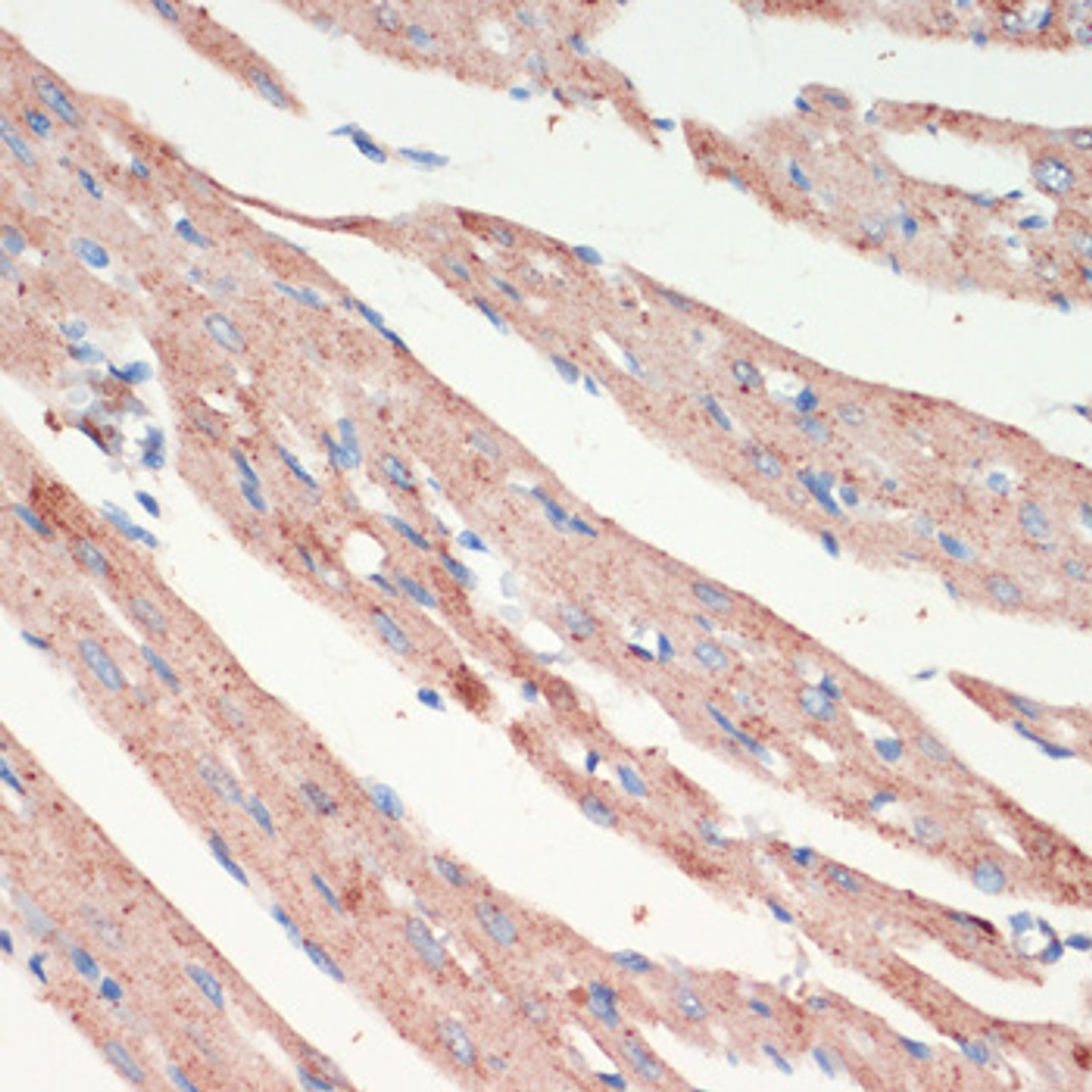 Immunohistochemistry of paraffin-embedded Rat heart using LRRK2 Polyclonal Antibody at dilution of  1:200 (40x lens).