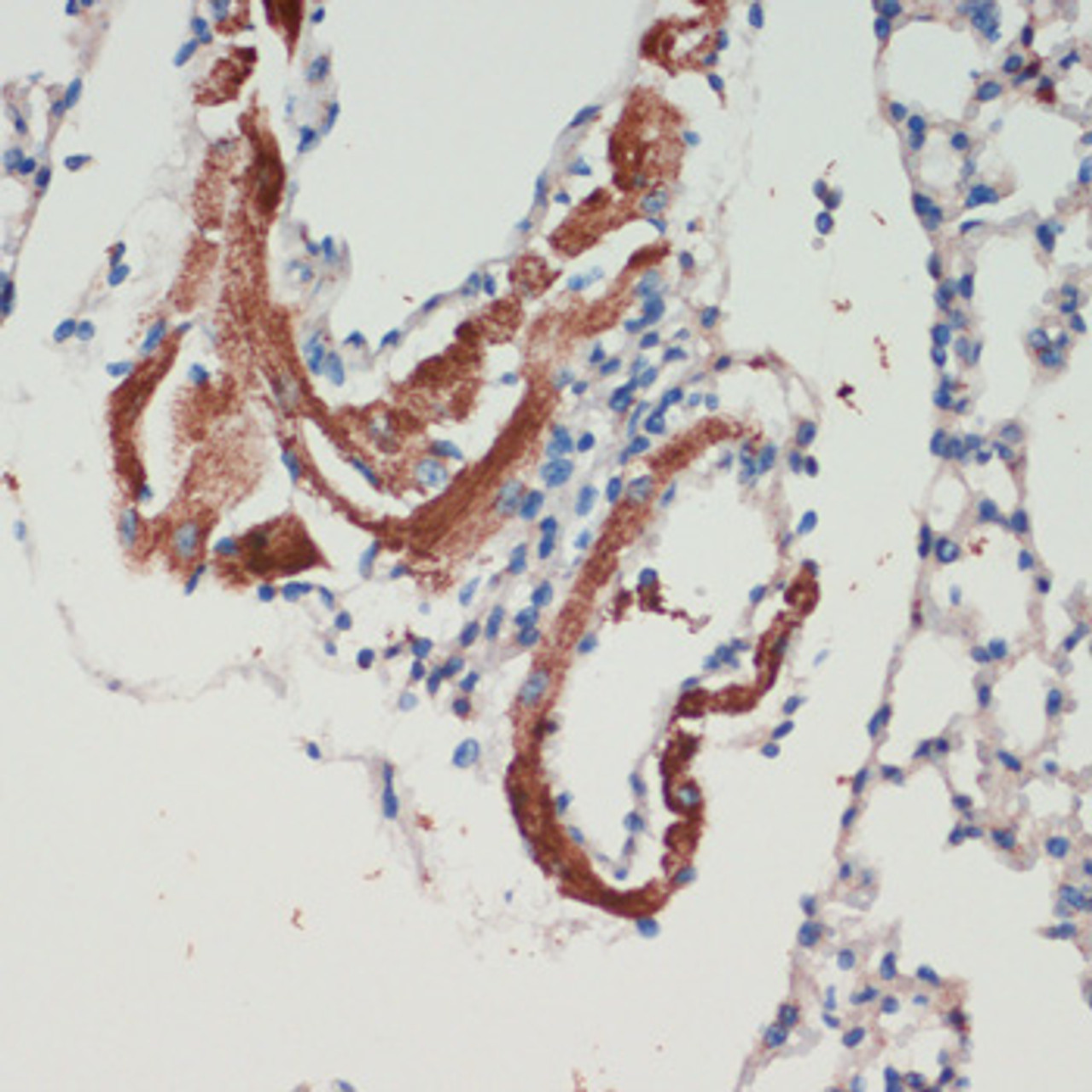 Immunohistochemistry of paraffin-embedded Mouse lung using LRRK2 Polyclonal Antibody at dilution of  1:200 (40x lens).