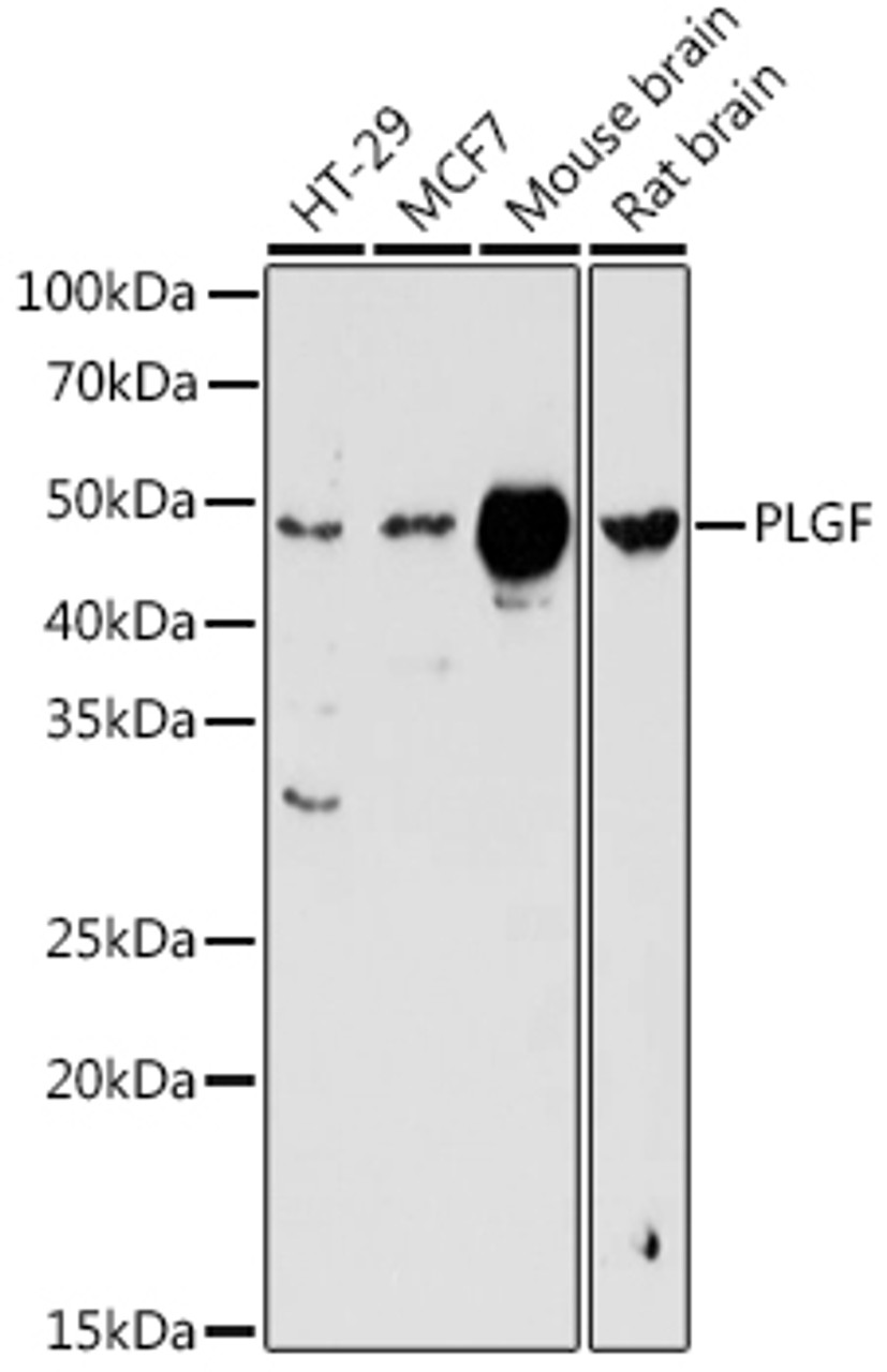 Western blot analysis of extracts of various cell lines using PLGF Polyclonal Antibody at dilution of 1:1000.