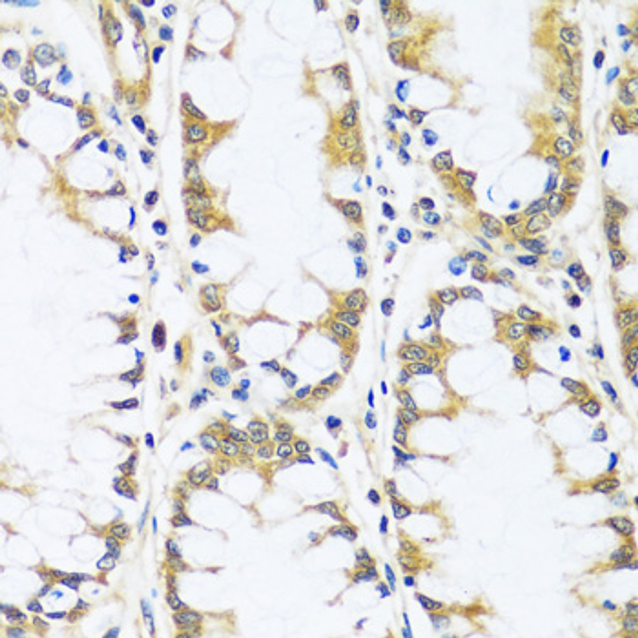 Immunohistochemistry of paraffin-embedded Human colon using BLOC1S3 Polyclonal Antibody at dilution of  1:100 (40x lens).
