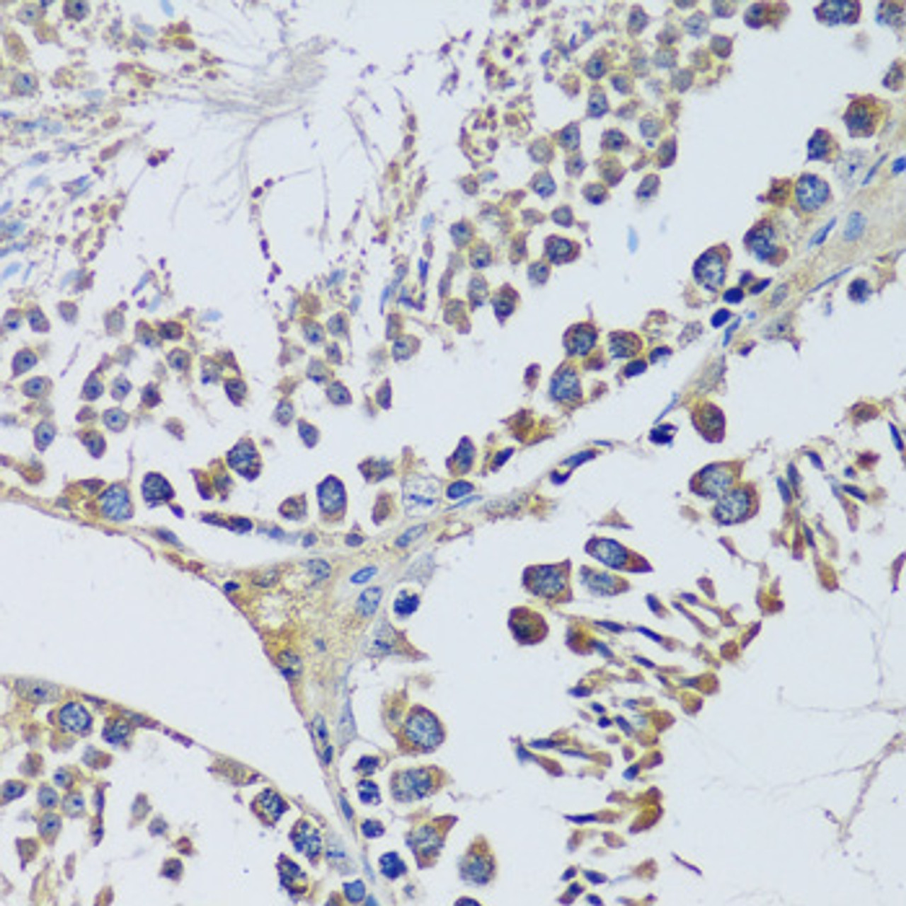 Immunohistochemistry of paraffin-embedded Mouse testis using BLOC1S3 Polyclonal Antibody at dilution of  1:100 (40x lens).