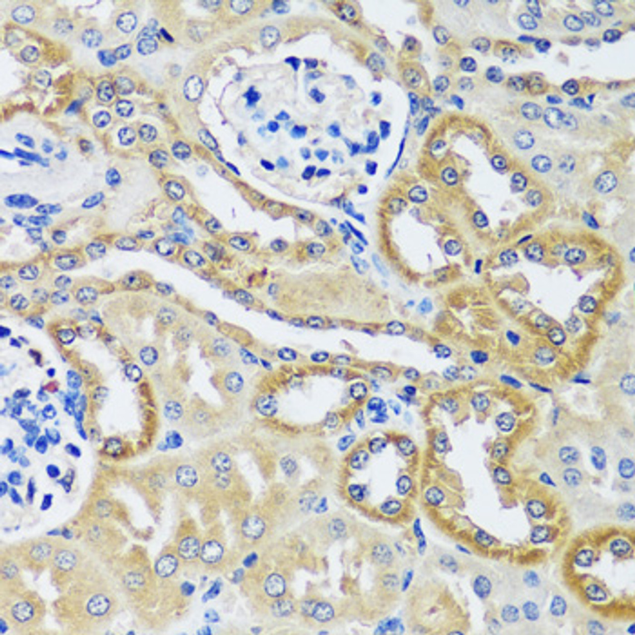 Immunohistochemistry of paraffin-embedded Mouse kidney using BLOC1S3 Polyclonal Antibody at dilution of  1:100 (40x lens).