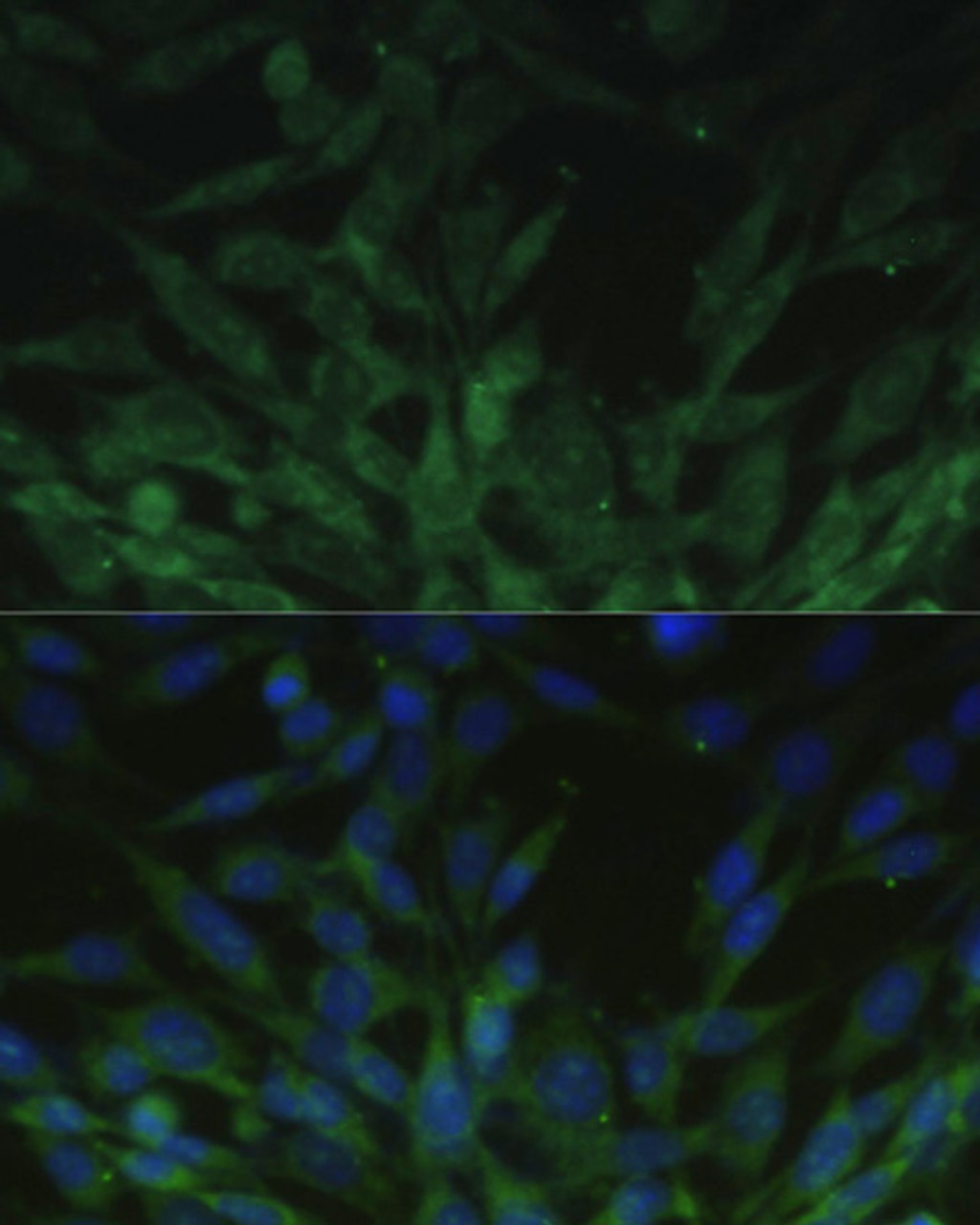 Immunofluorescence analysis of NIH-3T3 cells using BLOC1S3 Polyclonal Antibody at dilution of  1:100. Blue: DAPI for nuclear staining.