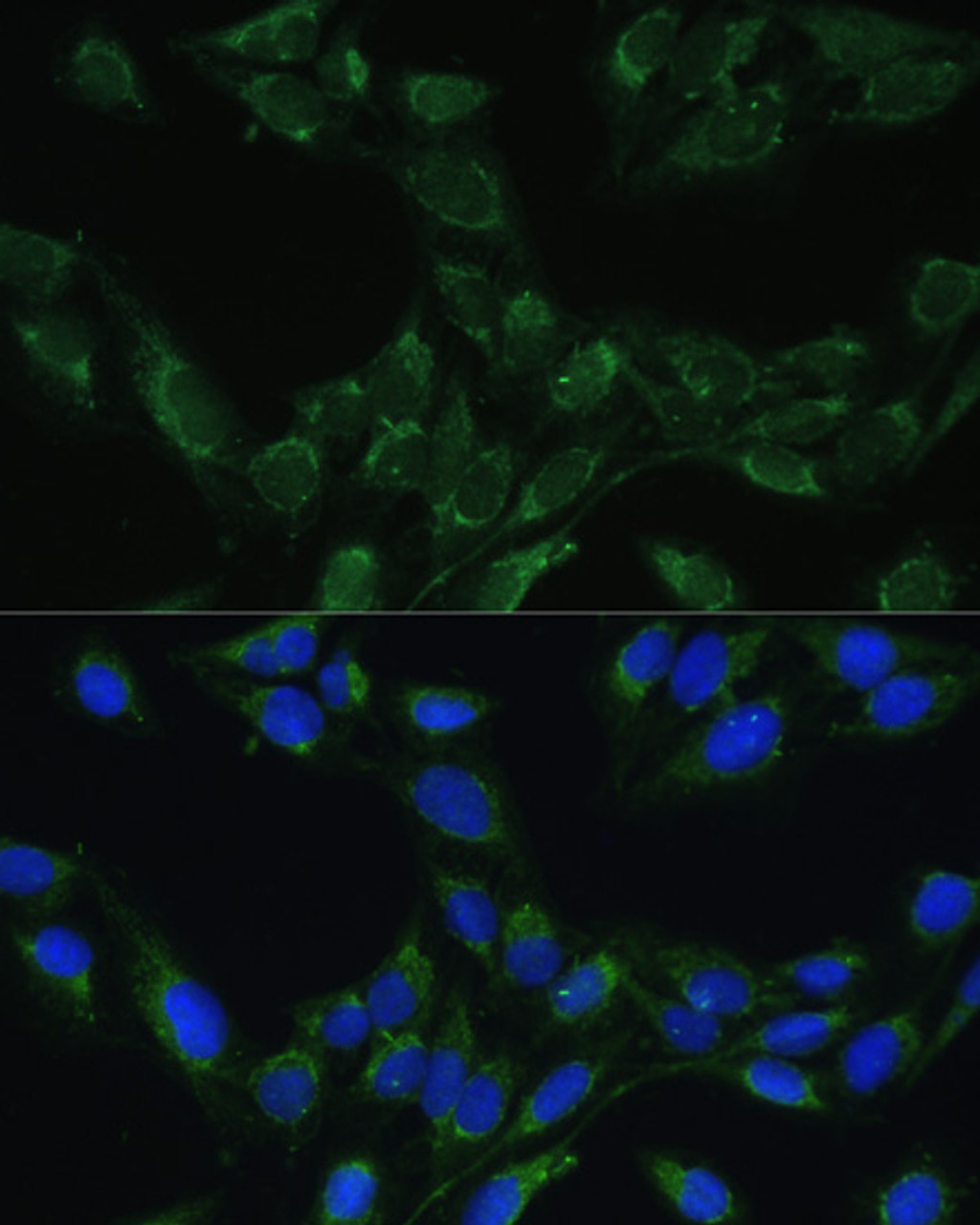 Immunofluorescence analysis of U-2 OS cells using BLOC1S3 Polyclonal Antibody at dilution of  1:100. Blue: DAPI for nuclear staining.