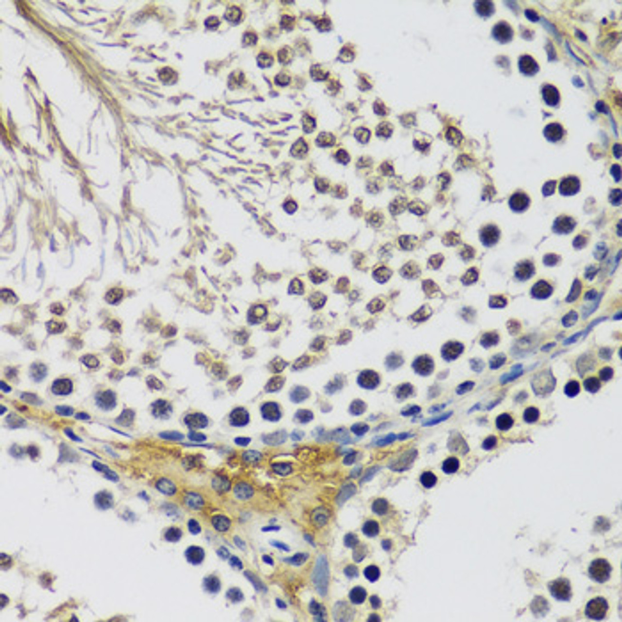Immunohistochemistry of paraffin-embedded Rat testis using C10orf62 Polyclonal Antibody at dilution of  1:100 (40x lens).