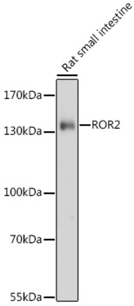 Western blot analysis of extracts of Rat small intestine using ROR2 Polyclonal Antibody at dilution of 1:1000.