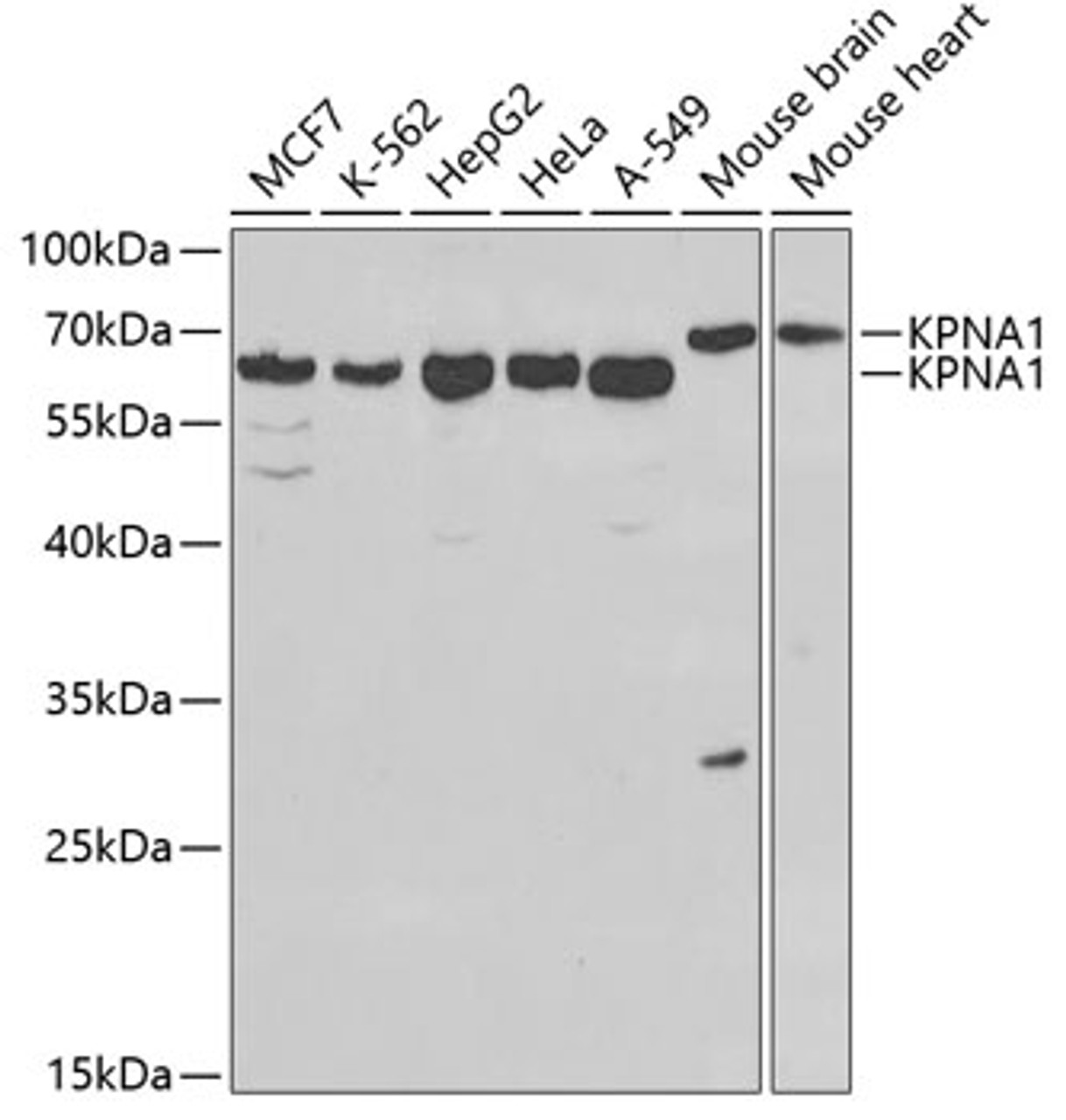 Western blot analysis of extracts of various cell lines using KPNA1 Polyclonal Antibody at dilution of 1:1000.