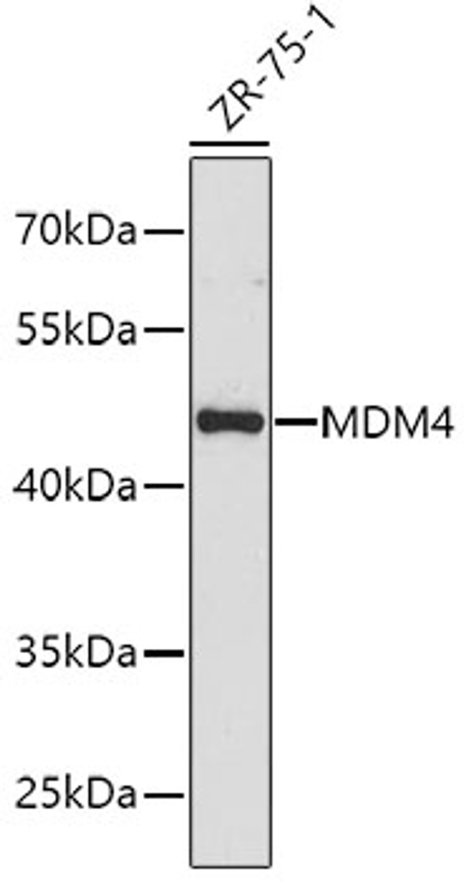 Western blot analysis of extracts of ZR-75-1 cells using MDM4 Polyclonal Antibody.