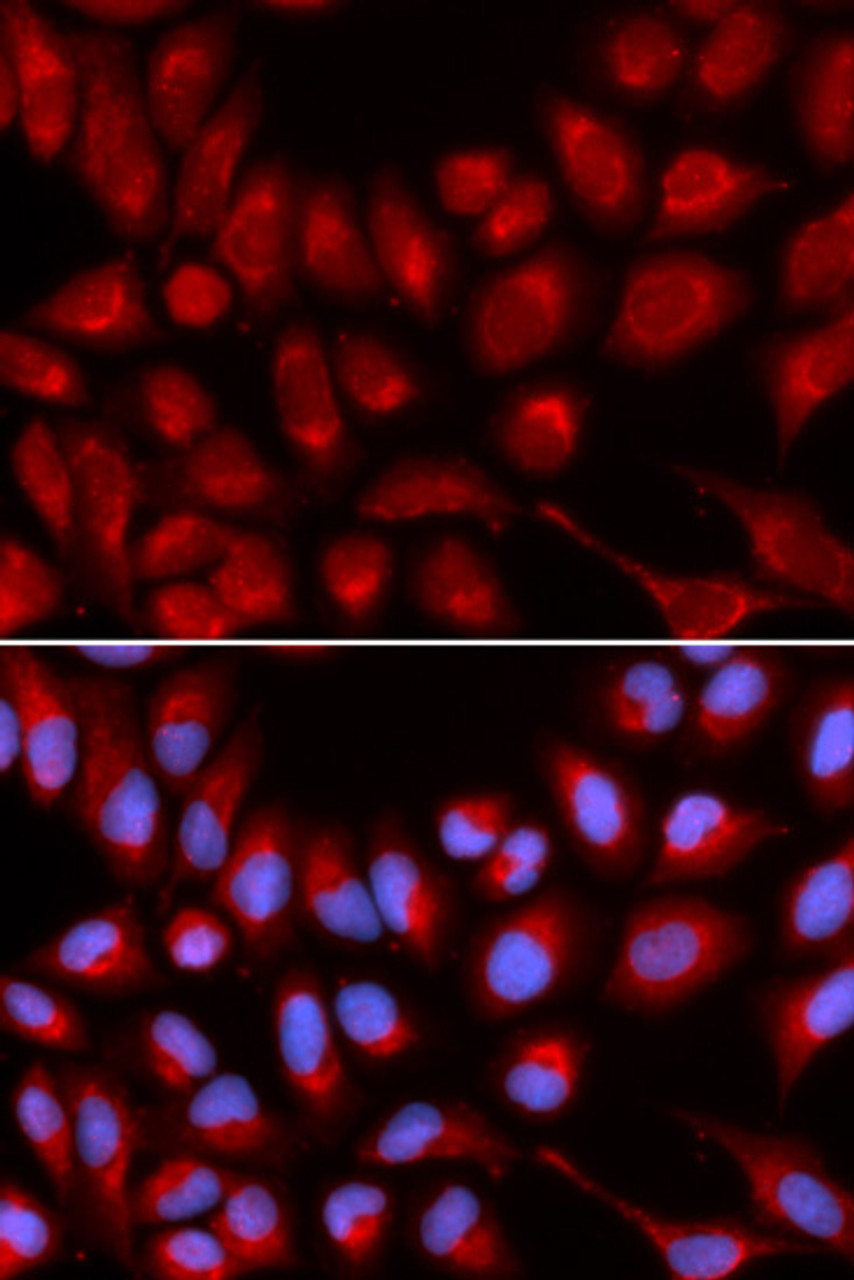 Immunofluorescence analysis of U2OS cells using IL16 Polyclonal Antibody