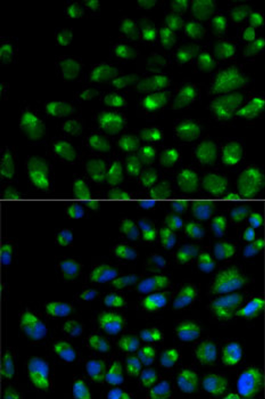Immunofluorescence analysis of U2OS cells using IFNAR2 Polyclonal Antibody