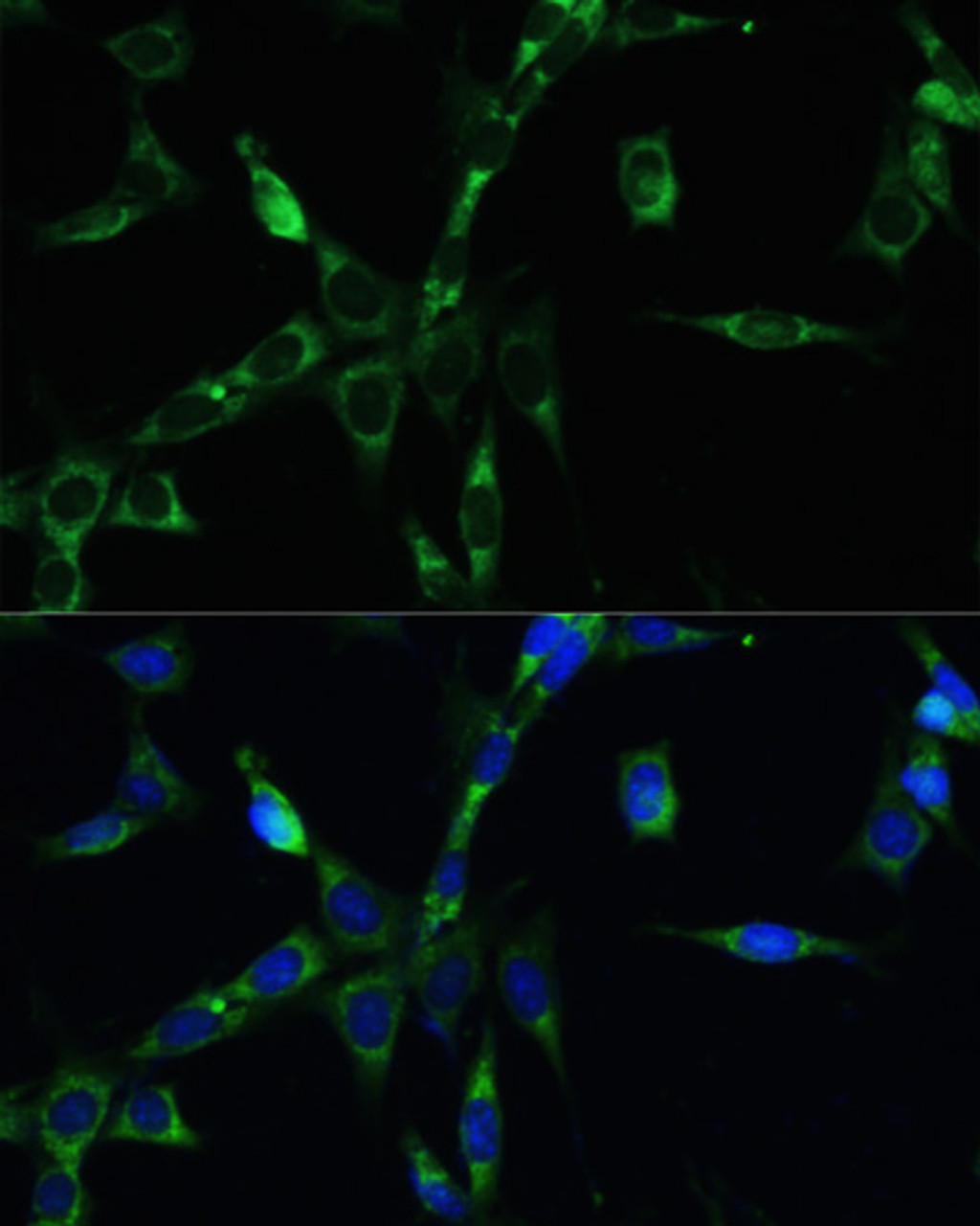 Immunofluorescence analysis of NIH-3T3 cells using BUB1B Polyclonal Antibody at dilution of  1:100. Blue: DAPI for nuclear staining.