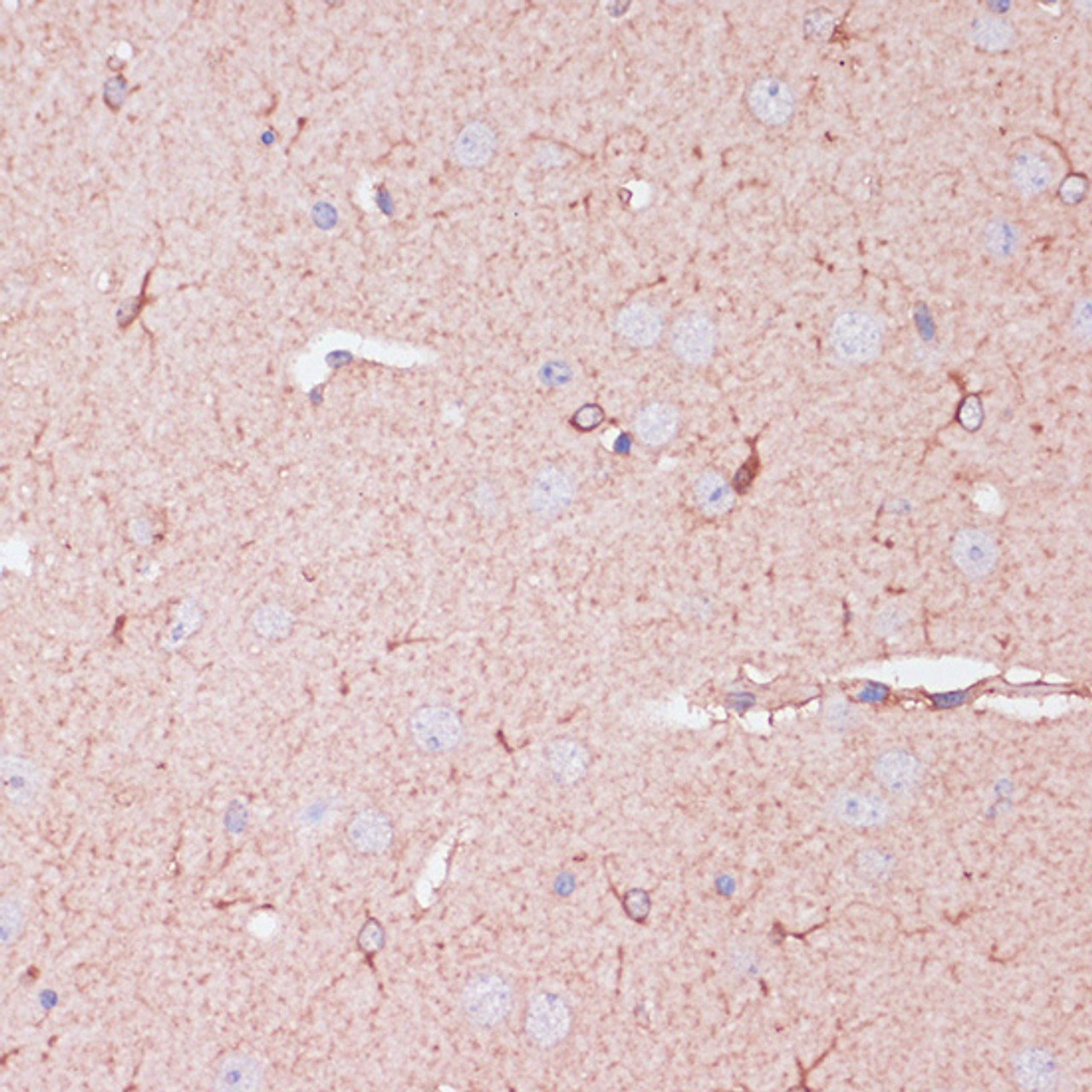 Immunohistochemistry of paraffin-embedded Mouse brain using CD82 Polyclonal Antibody at dilution of  1:100 (40x lens).