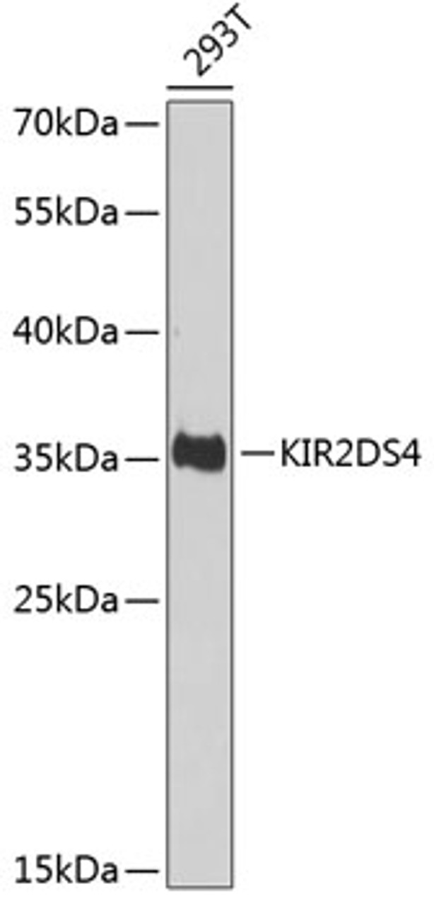 Western blot analysis of extracts of 293T cells using KIR2DS4 Polyclonal Antibody at dilution of 1:1000.