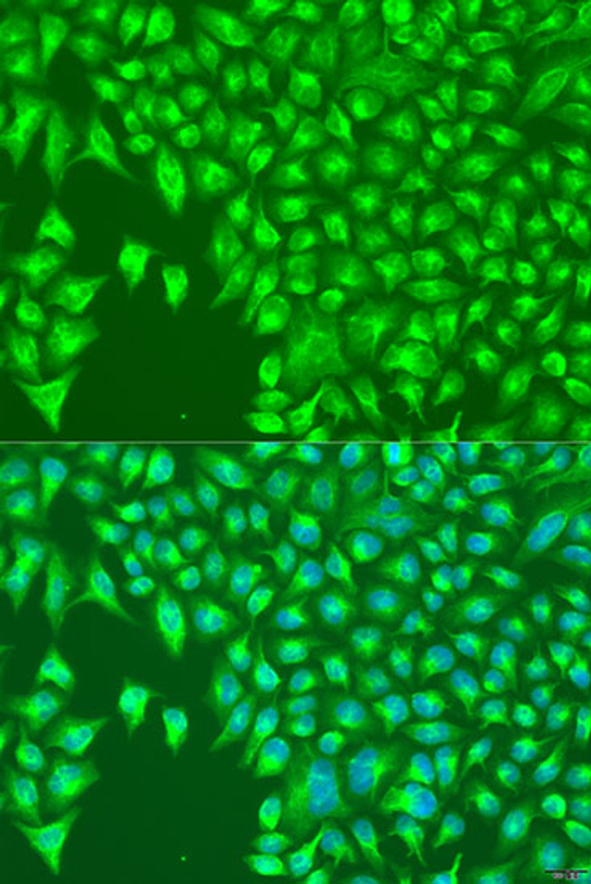 Immunofluorescence analysis of U2OS cells using KIR2DS4 Polyclonal Antibody at dilution of  1:100. Blue: DAPI for nuclear staining.