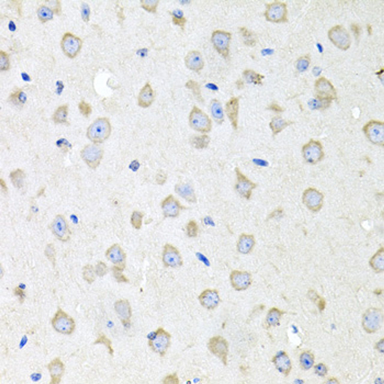 Immunohistochemistry of paraffin-embedded Mouse brain using CTSK Polyclonal Antibody at dilution of  1:100 (40x lens).