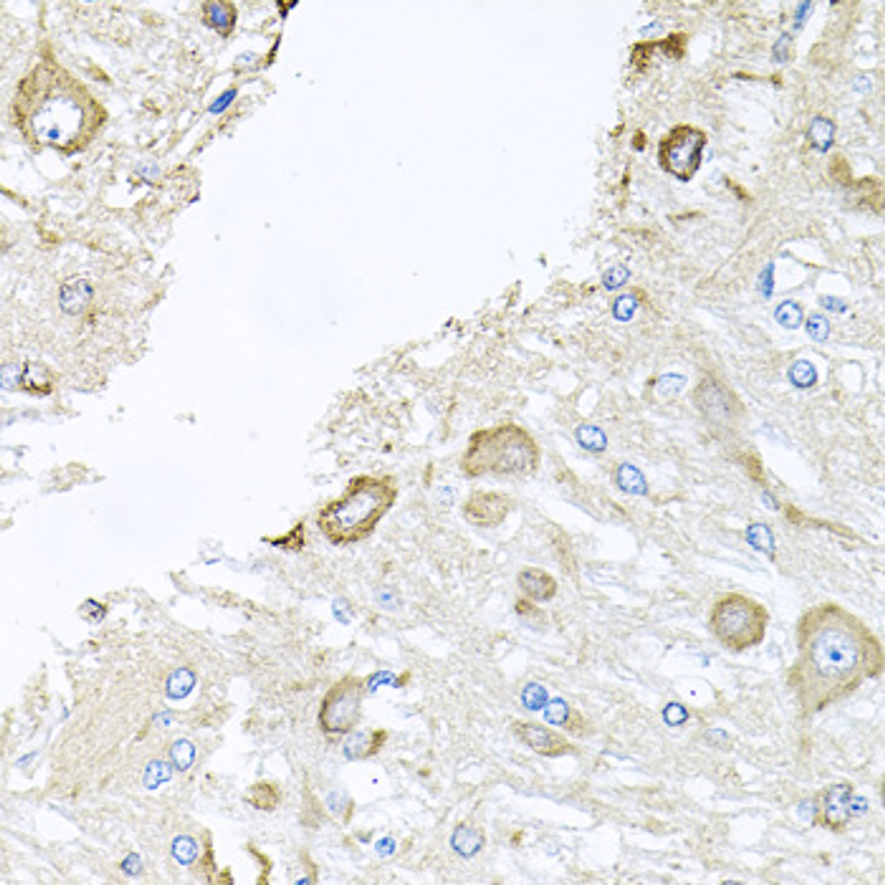 Immunohistochemistry of paraffin-embedded Rat brain using CTSK Polyclonal Antibody at dilution of  1:100 (40x lens).