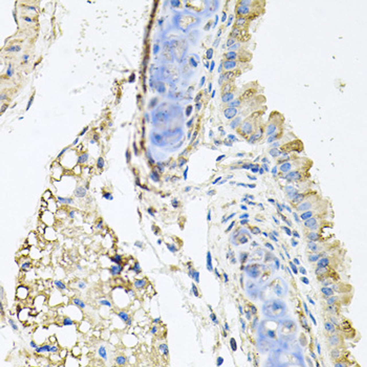Immunohistochemistry of paraffin-embedded Mouse lung using CTSK Polyclonal Antibody at dilution of  1:100 (40x lens).