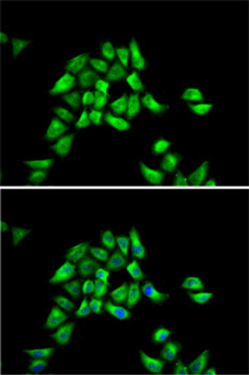 Immunofluorescence analysis of HeLa cells using DCTN1 Polyclonal Antibody