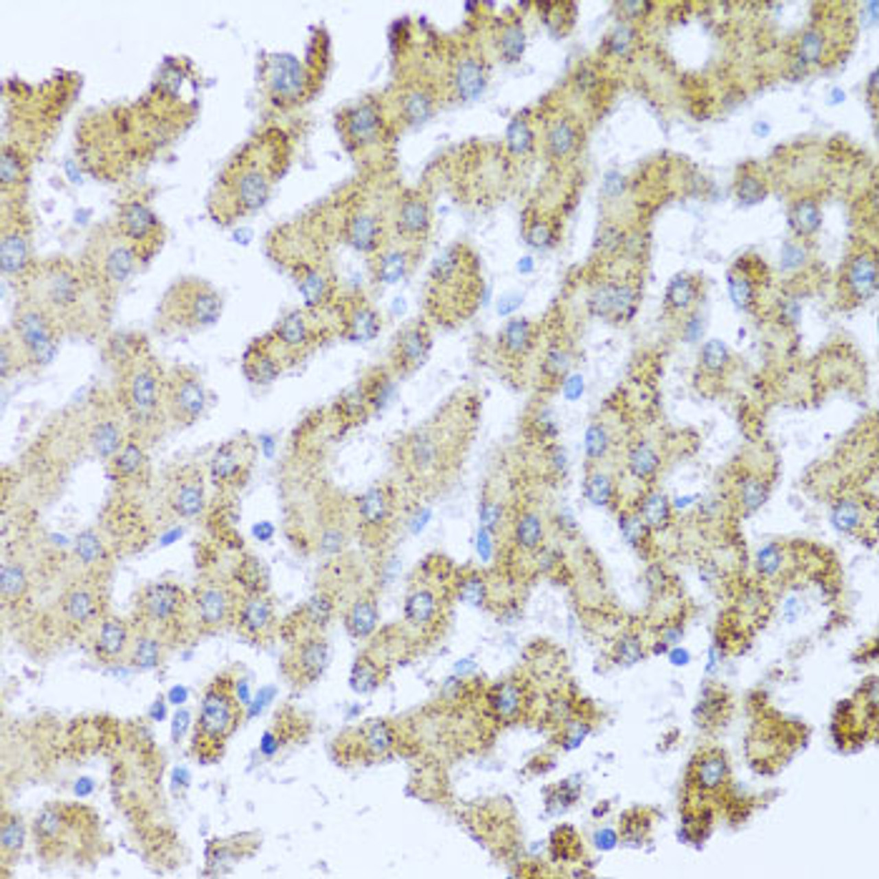 Immunohistochemistry of paraffin-embedded Human liver using MOK Polyclonal Antibody at dilution of  1:100 (40x lens).