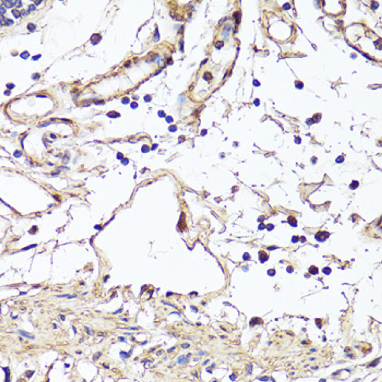 Immunohistochemistry of paraffin-embedded Human colon using VEGF Monoclonal Antibody at dilution of  1:150 (40x lens).