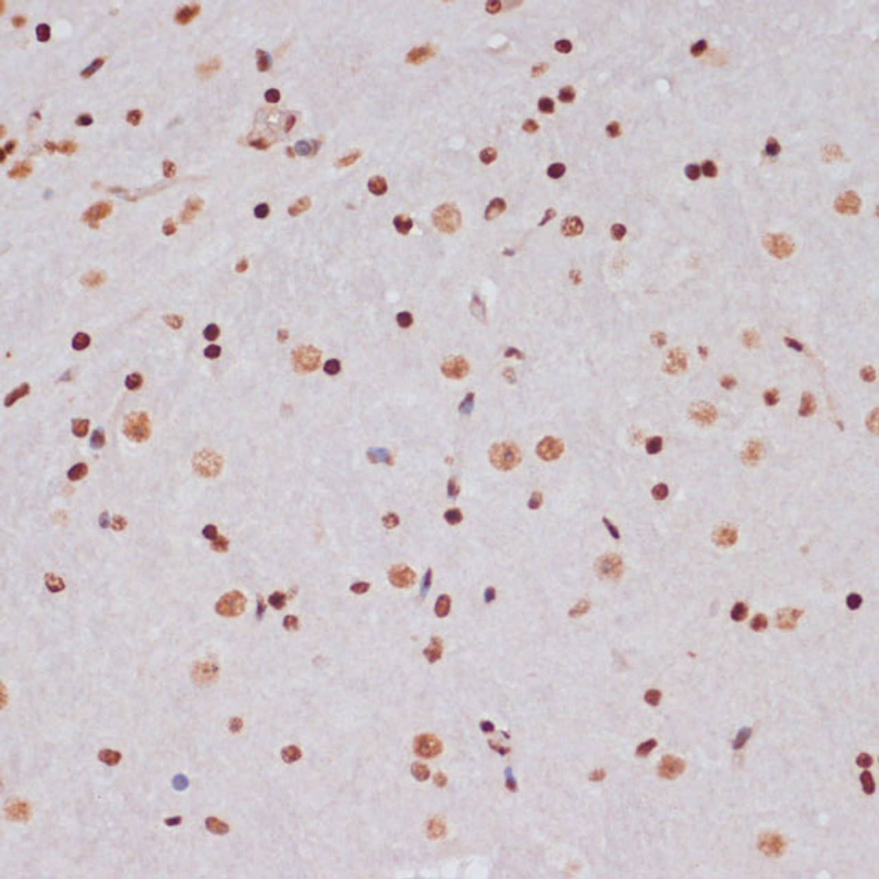 Immunohistochemistry of paraffin-embedded Mouse brain using Acetyl-Histone H3-K9/K14/K18/K23/K27 Polyclonal Antibody at dilution of  1:100 (40x lens).