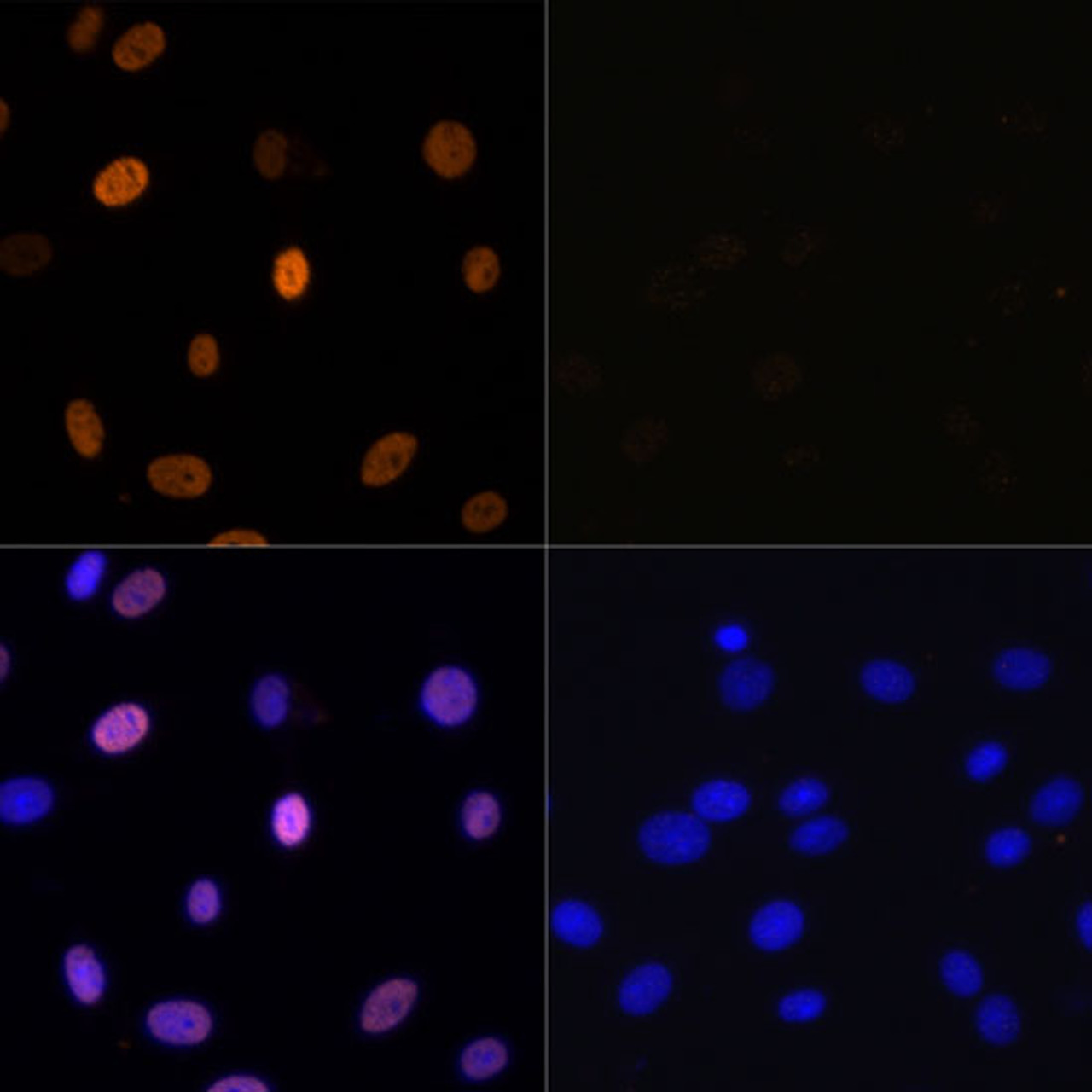 Immunofluorescence analysis of C6 cells using Acetyl-Histone H3-K9/K14/K18/K23/K27 Polyclonal Antibody at dilution of  1:100. Blue: DAPI for nuclear staining.C6 cells were treated by TSA (1 uM) at 37℃ for 18 hours. Blue: DAPI for nuclear staining.