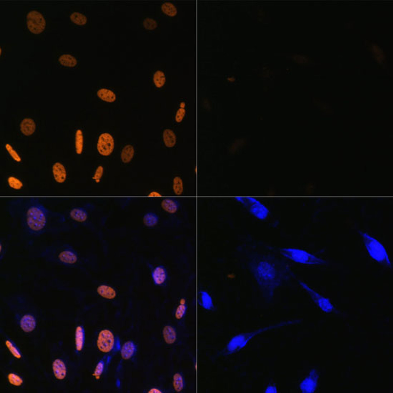 Immunofluorescence analysis of NIH/3T3 cells using Acetyl-Histone H3-K9/K14/K18/K23/K27 Polyclonal Antibody at dilution of  1:100. Blue: DAPI for nuclear staining.NIH/3T3 cells were treated by TSA (1 uM) at 37℃ for 18 hours. Blue: DAPI for nuclear staining.