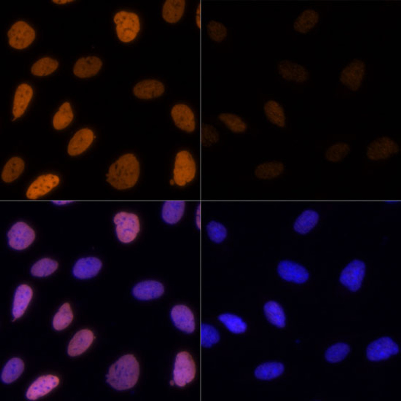 Immunofluorescence analysis of U-2 OS cells using Acetyl-Histone H3-K9/K14/K18/K23/K27 Polyclonal Antibody at dilution of  1:100. Blue: DAPI for nuclear staining.U2OS cells were treated by TSA (1 uM) at 37℃ for 18 hours. Blue: DAPI for nuclear staining.