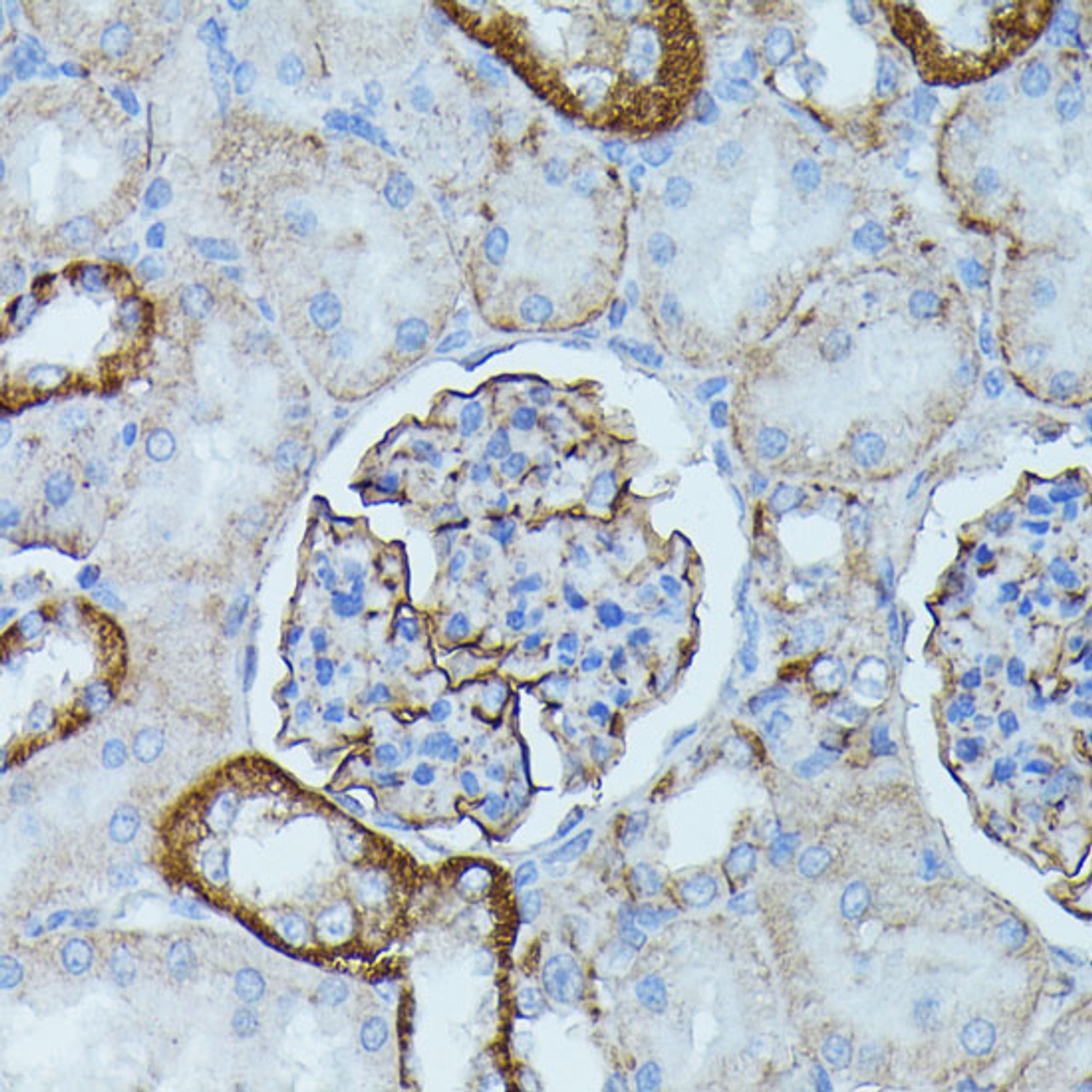 Immunohistochemistry of paraffin-embedded Rat kidney using PDE3A Polyclonal Antibody at dilution of  1:100 (40x lens).