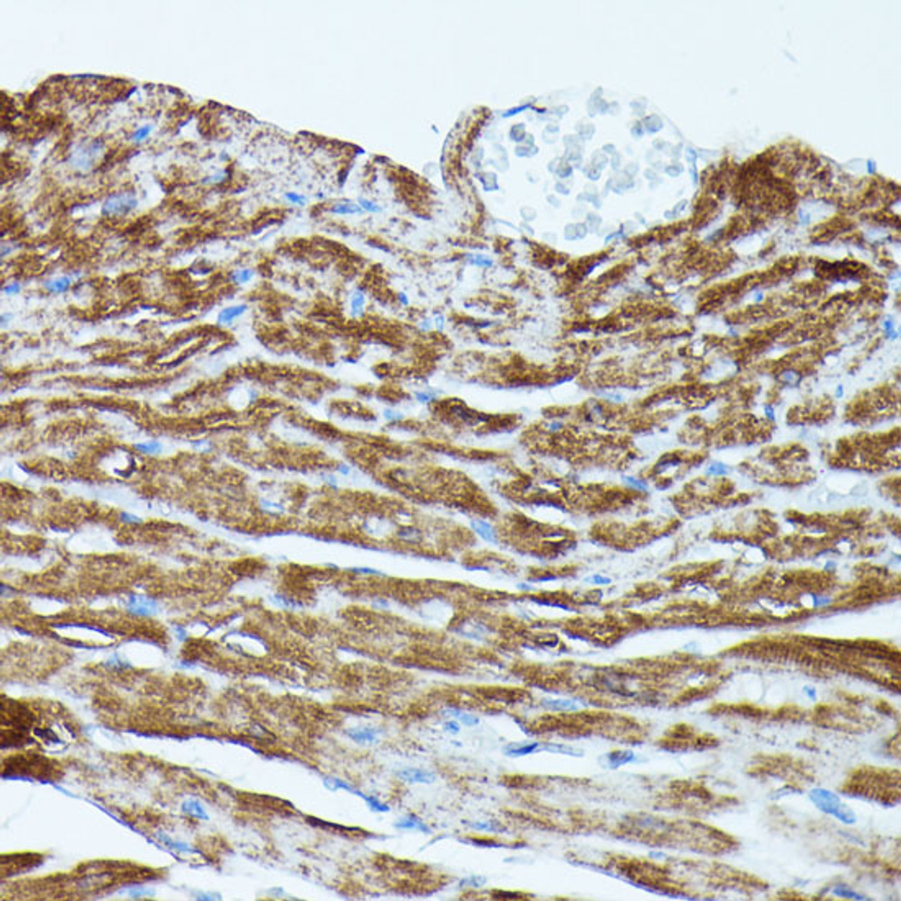 Immunohistochemistry of paraffin-embedded Mouse heart using PDE3A Polyclonal Antibody at dilution of  1:100 (40x lens).
