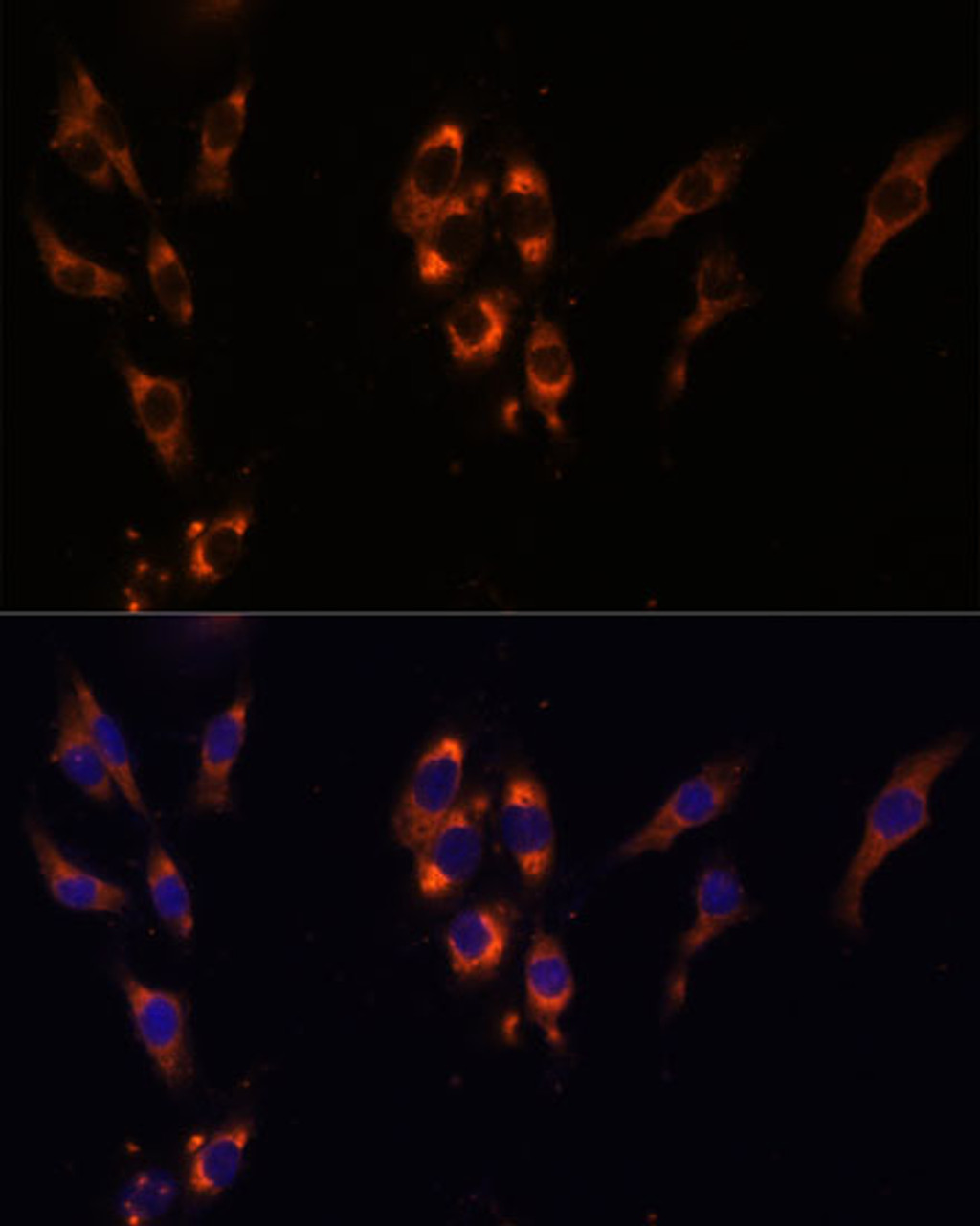 Immunofluorescence analysis of HeLa cells using PDE3A Polyclonal Antibody at dilution of  1:100 (40x lens). Blue: DAPI for nuclear staining.