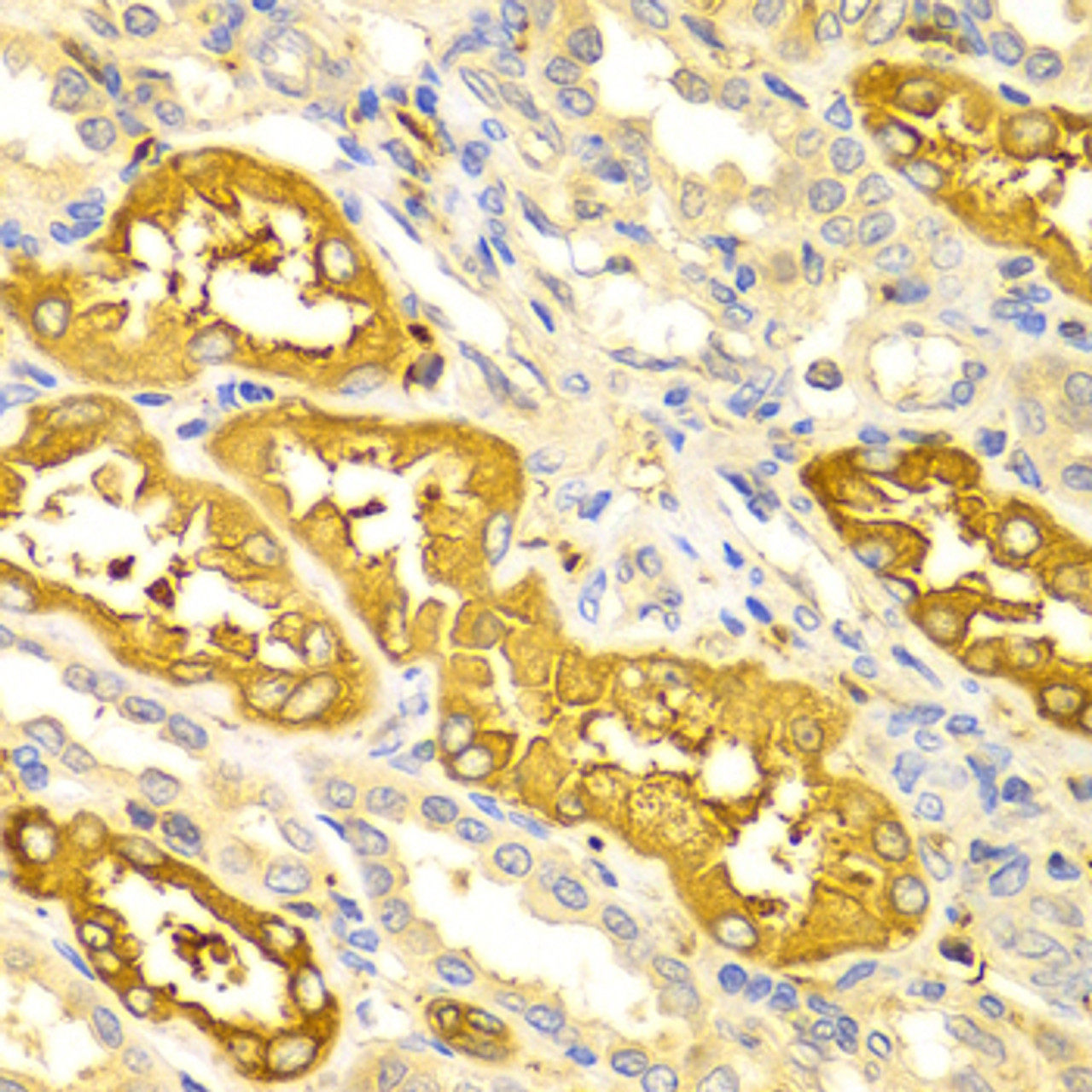 Immunohistochemistry of paraffin-embedded Human kidney using BIN1 Polyclonal Antibody at dilution of  1:100 (40x lens).