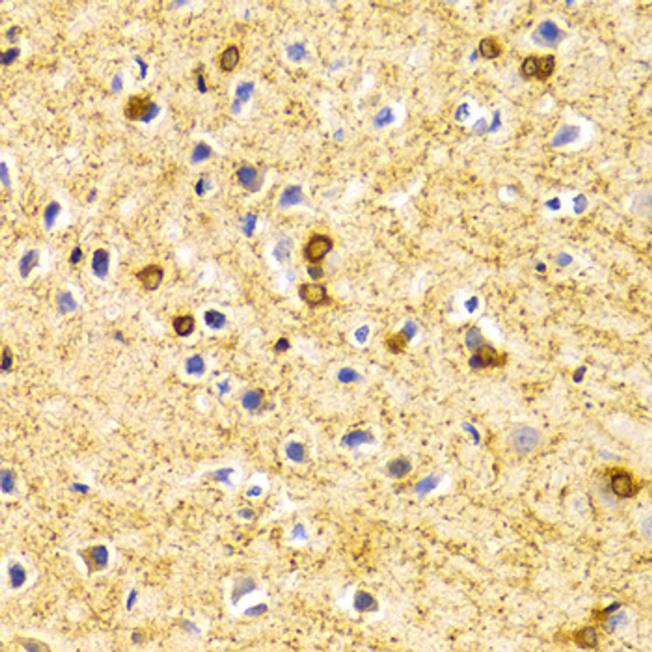 Immunohistochemistry of paraffin-embedded Rat brain using BIN1 Polyclonal Antibody at dilution of  1:100 (40x lens).