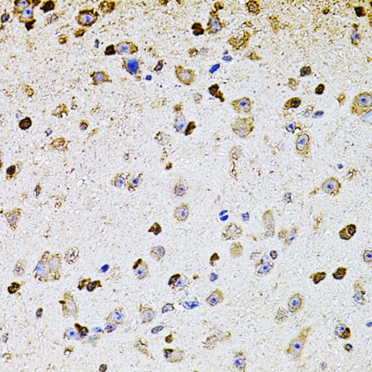 Immunohistochemistry of paraffin-embedded Mouse brain using ALDH1A1 Polyclonal Antibody at dilution of  1:100 (40x lens).