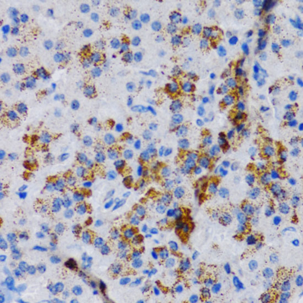 Immunohistochemistry of paraffin-embedded Rat pancreas using CYP24A1 Polyclonal Antibody at dilution of  1:200 (40x lens).