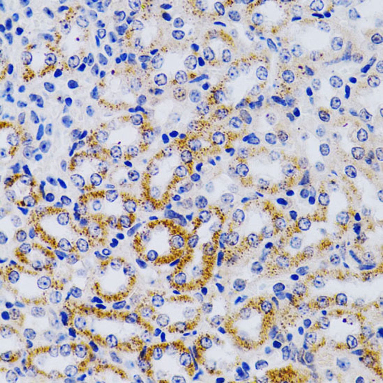 Immunohistochemistry of paraffin-embedded Mouse kidney using CYP24A1 Polyclonal Antibody at dilution of  1:200 (40x lens).
