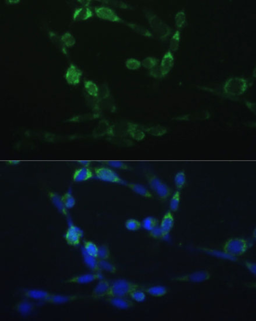 Immunofluorescence analysis of NIH-3T3 cells using CYP24A1 Polyclonal Antibody at dilution of  1:100 (40x lens). Blue: DAPI for nuclear staining.